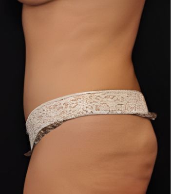 Side view of torso wearing light blue underwear.