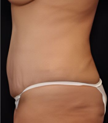 Profile of a person in underwear.